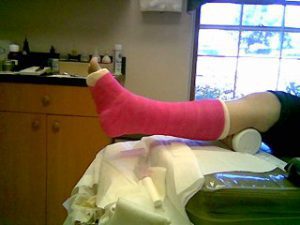 Rehabilitacja - złamana noga - Rydułtowy